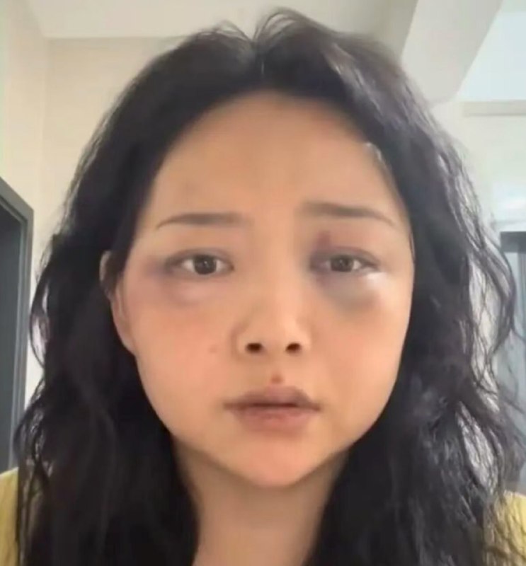菲律宾突发新闻现场图片